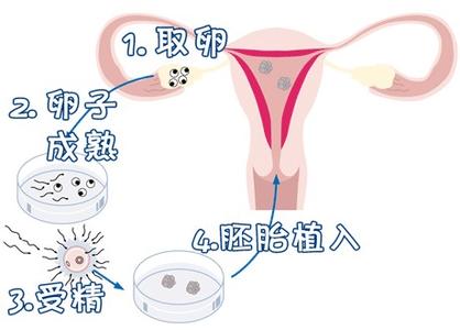 关于 试管婴儿包生男孩公司